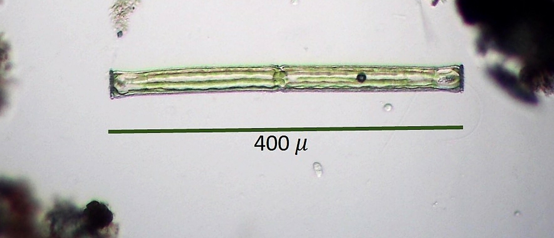 Pleurotaenium subcoronulatum