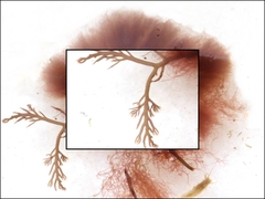 Rhodophyta