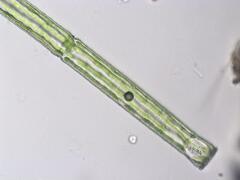 Pleurotaenium subcoronulatum