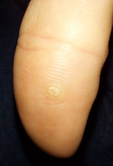 Firstpapillomavirinae