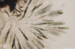 Rosellinia subsimilis