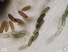 Rosellinia subsimilis