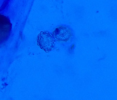Scutellinia fujianensis