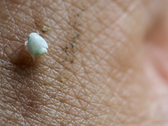 Flatormenis proxima