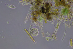 Cochliopodium