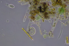 Cochliopodium