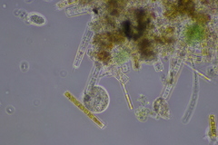 Cochliopodium