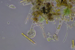 Cochliopodium
