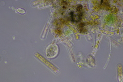 Cochliopodium