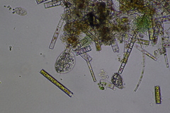 Cochliopodium