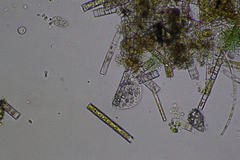 Cochliopodium