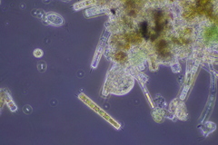 Cochliopodium