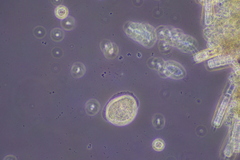 Cochliopodium