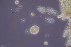 Cochliopodium