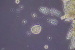Cochliopodium