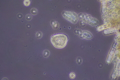 Cochliopodium