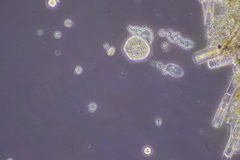 Cochliopodium