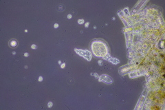 Cochliopodium