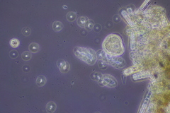 Cochliopodium