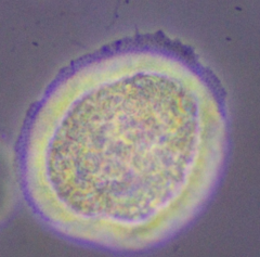 Cochliopodium