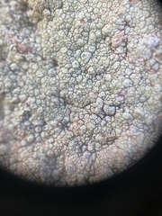 Pertusaria flavicunda