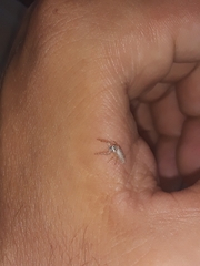 Hentzia