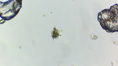 Amoebozoa