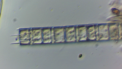 Aulacoseira muzzanensis