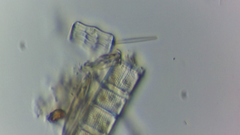 Aulacoseira muzzanensis