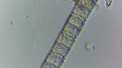 Aulacoseira muzzanensis