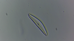 Cymbella