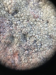 Pertusaria flavicunda