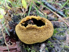 Scleroderma