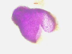 Nectriaceae
