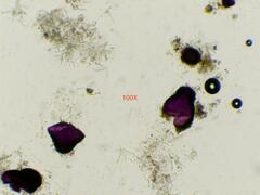 Nectriaceae
