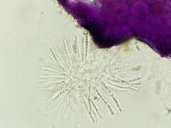 Nectriaceae
