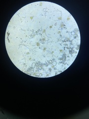 Bacteria