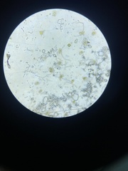 Bacteria