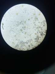 Bacteria