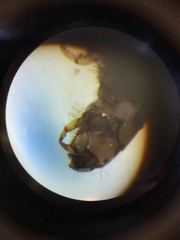 Hydropsychidae
