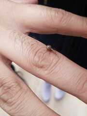 Cryptachaea veruculata