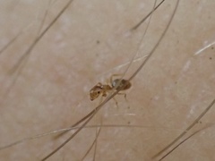 Brachymyrmex depilis