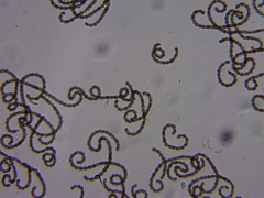 Dolichospermum lemmermannii