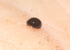 Zilus
