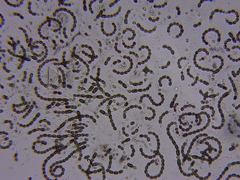 Dolichospermum lemmermannii