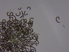 Dolichospermum lemmermannii