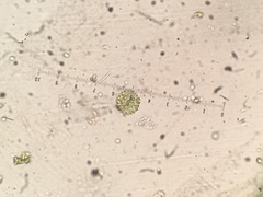 Pseudopediastrum