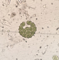 Pseudopediastrum