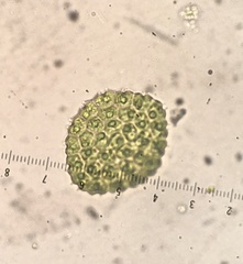 Pseudopediastrum
