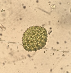 Pseudopediastrum